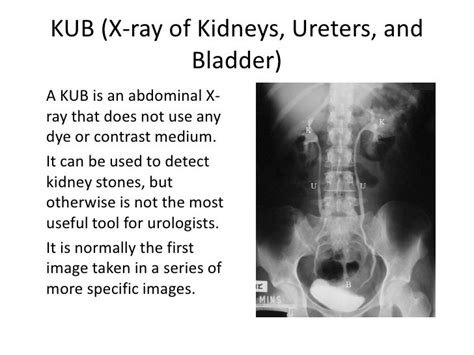 kubmedical abbreviation|What Is a Kidney Ureter Bladder X.